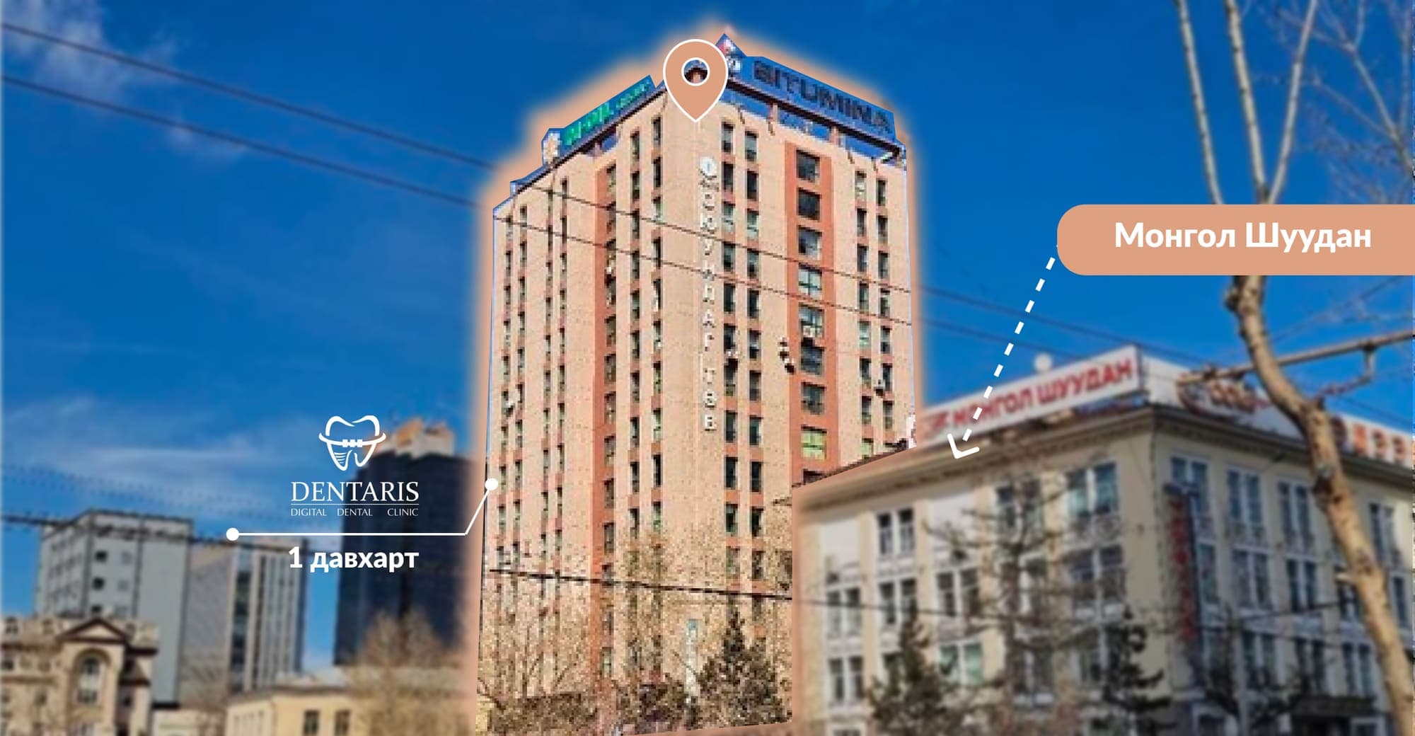 Өнгөц цоорлын эмчилгээ