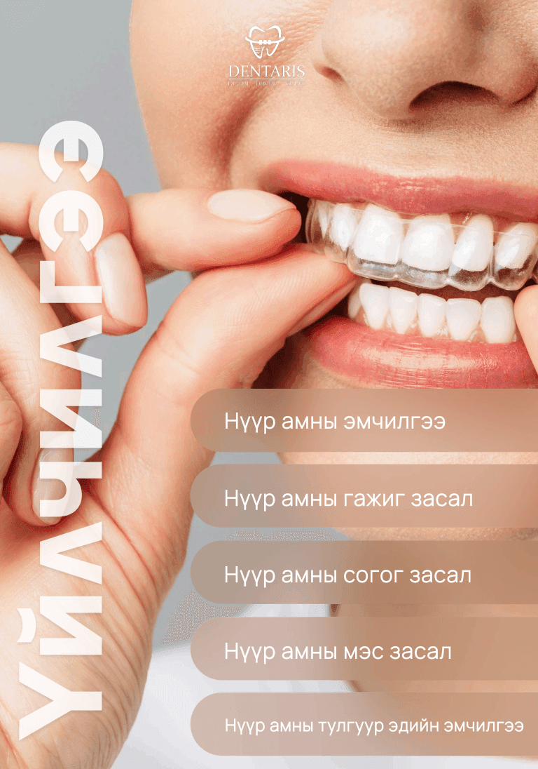 Үйлчилгээ 1